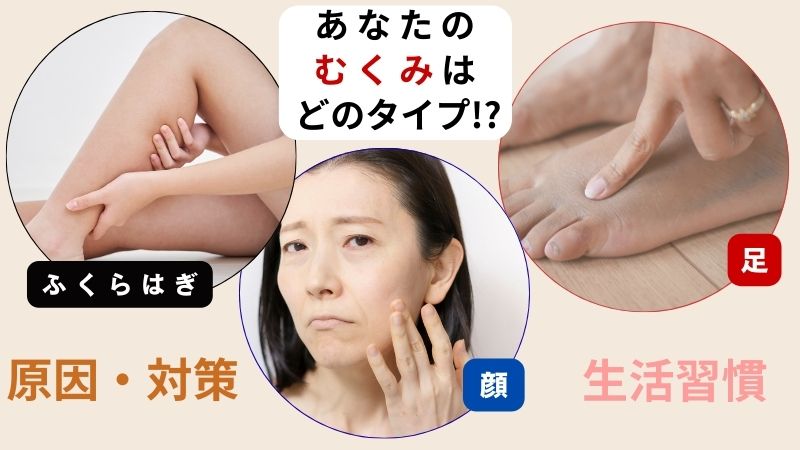 あなたのむくみはどのタイプ⁉